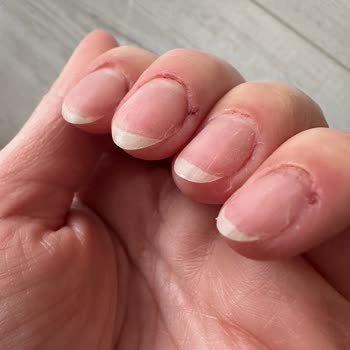 Güzellik Merkezinde Kâbus: Yanlış İşlem Ve İlgisizlik