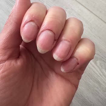 Güzellik Merkezinde Kâbus: Yanlış İşlem Ve İlgisizlik