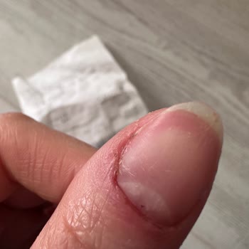 Güzellik Merkezinde Kâbus: Yanlış İşlem Ve İlgisizlik