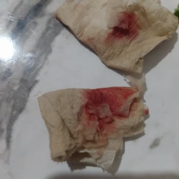 Mantı İçinde Tehlikeli Yabancı Madde Bulundu