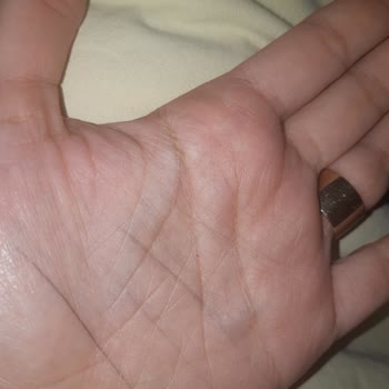 Trendyol'dan Gelen Kimyasal Atıklı Çatal Kaşık Şoku