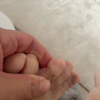 Ayakkabılarım Sağlığımı Tehdit Ediyor: Mağduriyetimin Giderilmesini İstiyorum