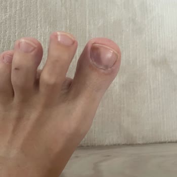 Ayakkabılarım Sağlığımı Tehdit Ediyor: Mağduriyetimin Giderilmesini İstiyorum