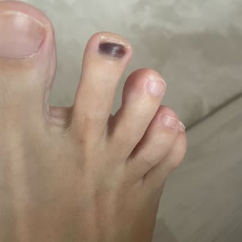 Ayakkabılarım Sağlığımı Tehdit Ediyor: Mağduriyetimin Giderilmesini İstiyorum