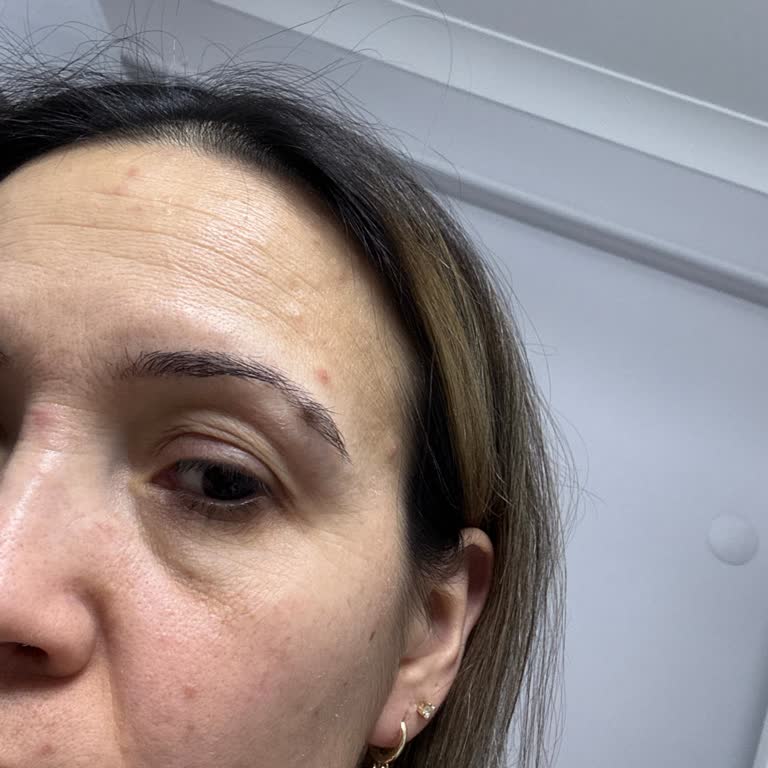 Yves Rocher Nemlendirici Krem Cilt Sorunlarına Yol Açtı