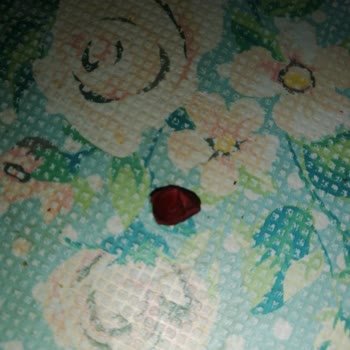 Dondurma İçerisinde Tehlikeli Yabancı Madde