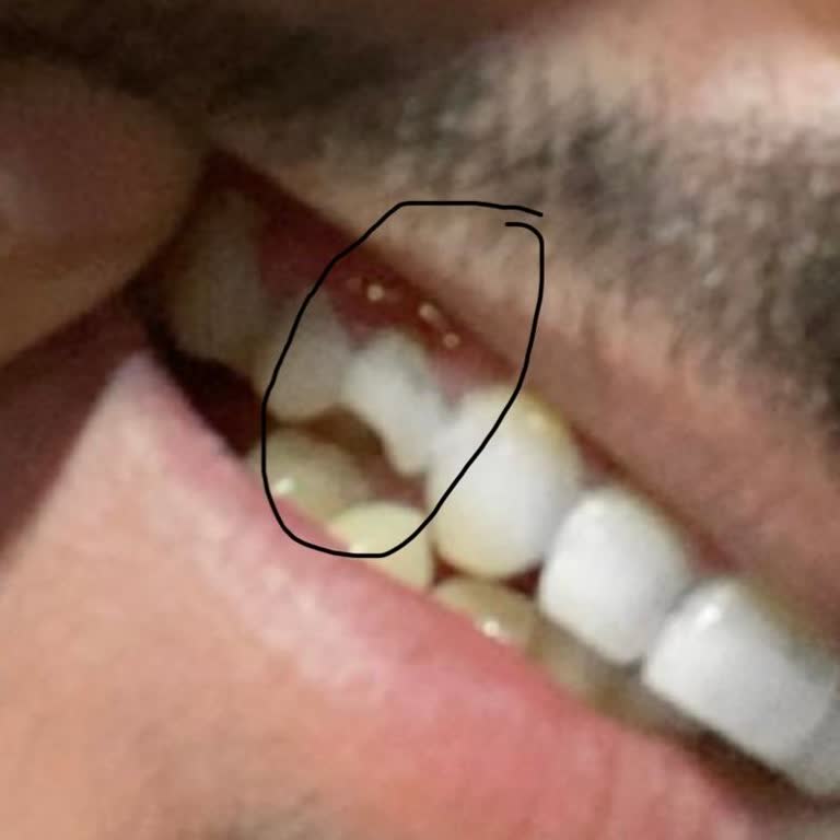 Darıca Dekadent 2'de Hatalı Diş Tedavisi Deneyimi