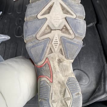 Skechers Ayakkabıda Beklenmedik Dayanıklılık Sorunu