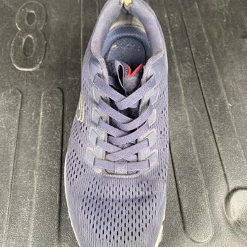 Skechers Ayakkabıda Beklenmedik Dayanıklılık Sorunu