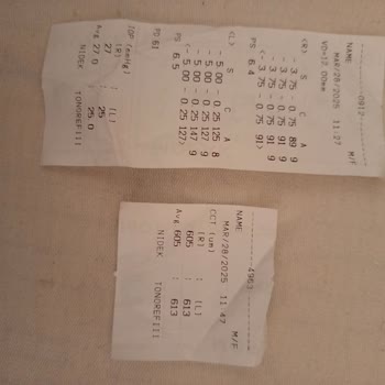 Yanlış Lens Reçetesi Ve Saygısız Muamele