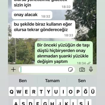 Atasay'dan Aldığım Yüzüğün Sürekli Taş Düşmesi Ve Değişim Sorunu