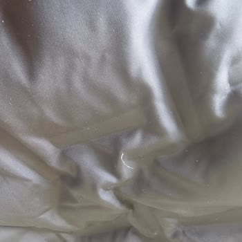 Columbia Montun Tüy Sorunu Ve A101 İletişim Problemleri