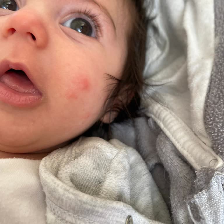 Bebeğimde Alerjiye Sebep Olan Krem