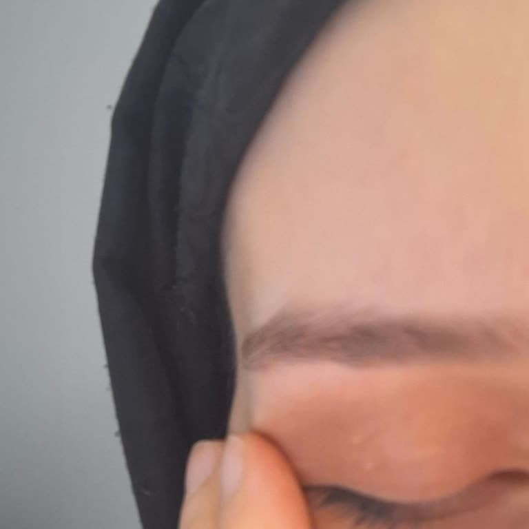 Loreal Paris Göz Serumu Sonrası Beklenmedik Yağ Bezeleri!