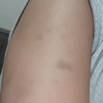 Güzellik Merkezinde Yaşanan Sözleşme ve İletişim Problemleri