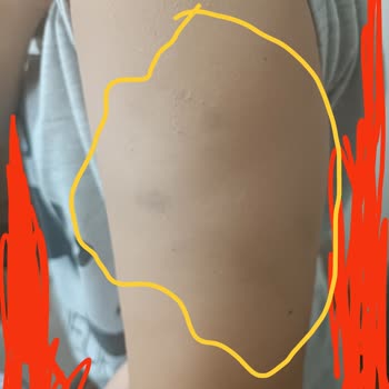 Güzellik Merkezinde Yaşanan Sözleşme ve İletişim Problemleri