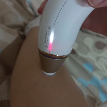 Arızalı Braun IPL Cihazı İle Mağduriyet
