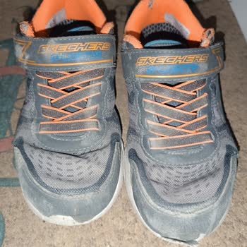 Skechers Büyük Markanın Küçük Ayıbı: 4 Ayda Parçalanan Ayakkabı