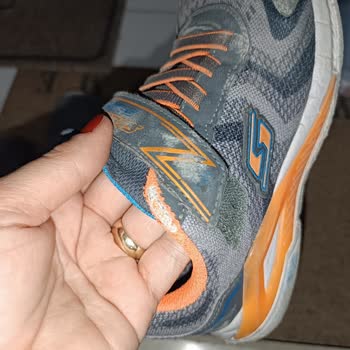 Skechers Büyük Markanın Küçük Ayıbı: 4 Ayda Parçalanan Ayakkabı