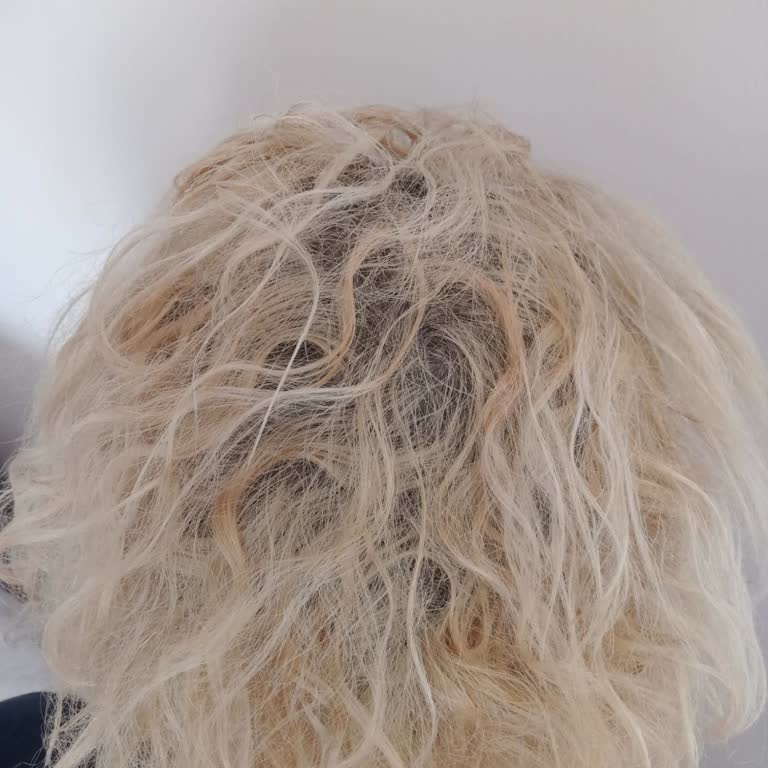 Kuaförde Beklenmeyen Saç Sorunları