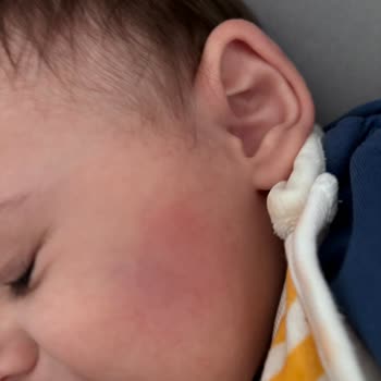 Mustela Ürünü Beklenmedik Reaksiyona Sebep Oldu