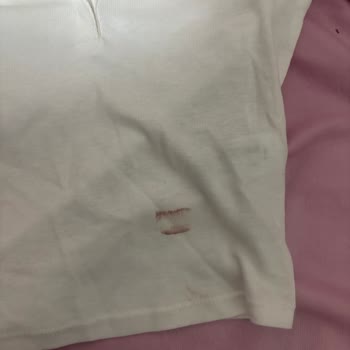 Defolu Ürün Ve Eksik Bilgilendirme İle Hayal Kırıklığı