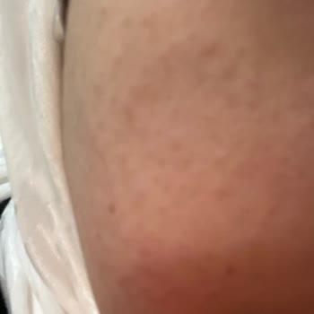 Maruderm Alerji Yapan Yüz Yıkama Jeli!