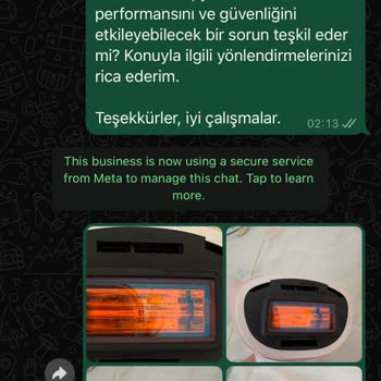 Philips Lumea Cihazında Yanık Benzeri Lekeler Ve Yetersiz Müşteri Hizmetleri