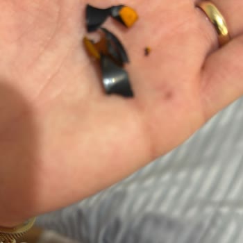 Dyson Ürün Kalitesi Ve Müşteri Hizmetleri Hayal Kırıklığı