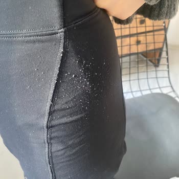 Oysho Taytında Beklenmedik Tüylenme Sorunu