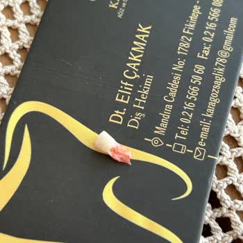 Çocuk Diş Hekimi Yanıltması Ve Kaba Davranışlar