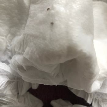 Sleepy Bebek Bezi Hijyen Sorunu İle Hayal Kırıklığı
