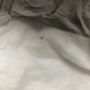 Sleepy Bebek Bezi Hijyen Sorunu İle Hayal Kırıklığı