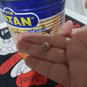 Nohut Konservesinde Taş Şoku: Diş Kırma Tehlikesi!