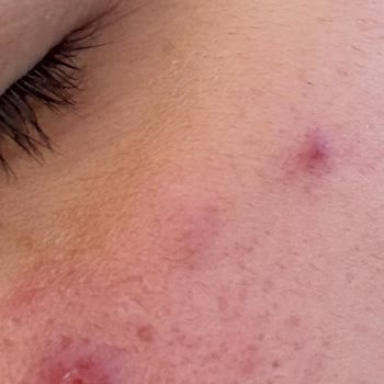 Caudalie Vinapure, productos causaron problemas en mi piel