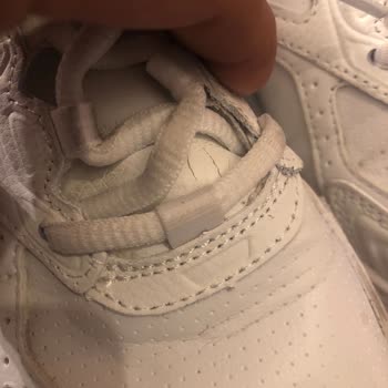 Skechers Ayakkabıda 1 Ayda Deformasyon Şoku