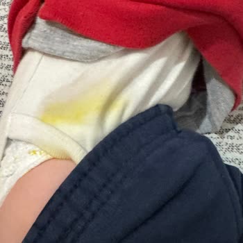 Prima Premium Bebek Bezi Sızıntı Sorunu!