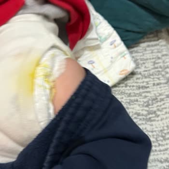 Prima Premium Bebek Bezi Sızıntı Sorunu!