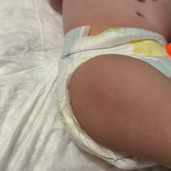 Prima Premium Bebek Bezi Sızıntı Sorunu!