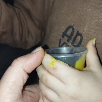 Oyun Hamuru Tehlikesi: Çocuğumun Ellerine Zarar Verdi!