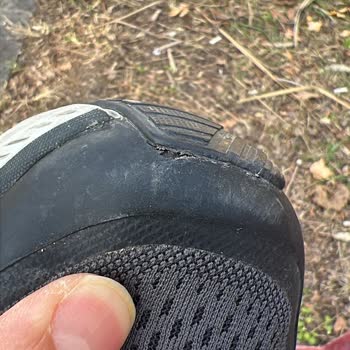 Skechers Ayakkabının Kalitesizliği Ve Müşteri Hizmetleri Hayal Kırıklığı