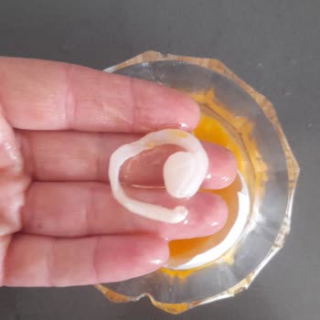 BİM'den Aldığım Yumurtalarda Şok Edici Durum