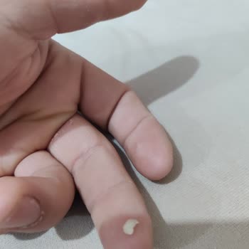 Özel Dent Trio Ağız Ve Diş Sağlığı Polikliniği Söylenen İşlem Yapılmadı Yapılmış Gibi Parası Alındı!
