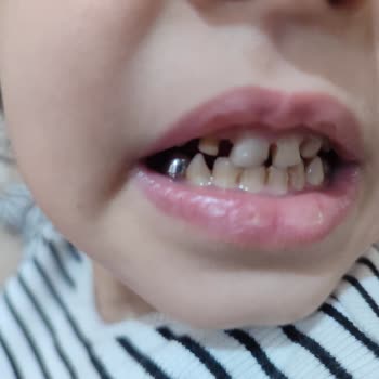 Özel Dent Trio Ağız Ve Diş Sağlığı Polikliniği Söylenen İşlem Yapılmadı Yapılmış Gibi Parası Alındı!