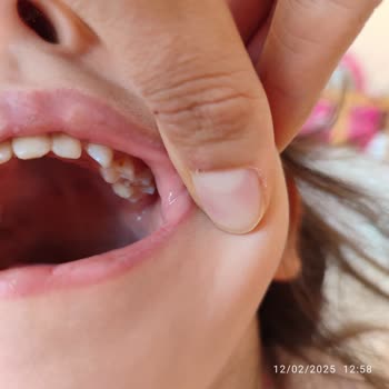 Özel Dent Trio Ağız Ve Diş Sağlığı Polikliniği Söylenen İşlem Yapılmadı Yapılmış Gibi Parası Alındı!