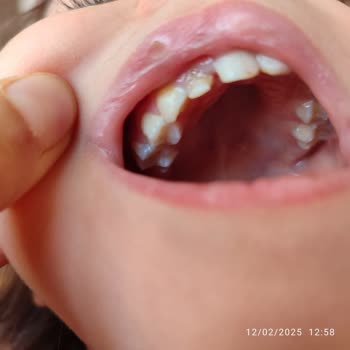 Özel Dent Trio Ağız Ve Diş Sağlığı Polikliniği Söylenen İşlem Yapılmadı Yapılmış Gibi Parası Alındı!