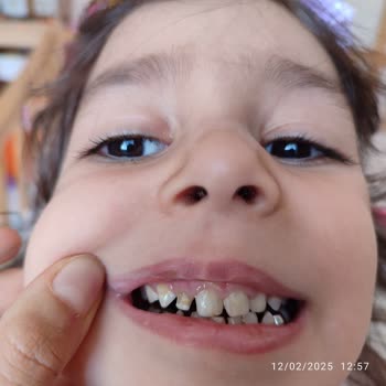 Özel Dent Trio Ağız Ve Diş Sağlığı Polikliniği Söylenen İşlem Yapılmadı Yapılmış Gibi Parası Alındı!