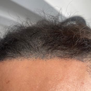 Yurt Dışından Gelen Müşteriye Haksız Fiyatlandırma Ve Kötü Hizmet