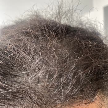 Yurt Dışından Gelen Müşteriye Haksız Fiyatlandırma Ve Kötü Hizmet