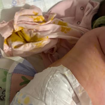 Molfix Bezleri Sızdırıyor: Bebekler İçin Güvenli Mi?